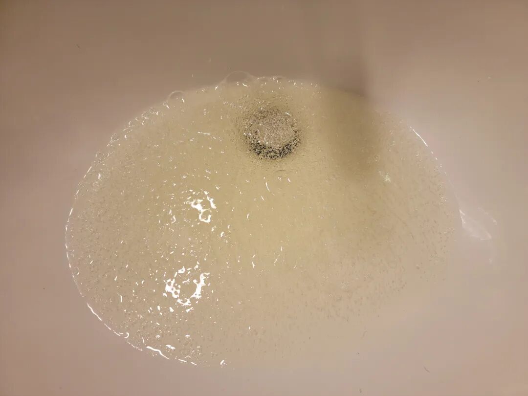 警惕清洁剂中隐藏的“化骨水”!你家可能也有→(图3) 警惕清洁剂中隐藏的“化骨水”!你家可能也有→(图3)